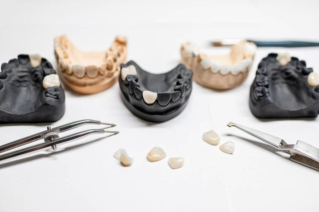 Zirconium Dental Veneer - WestModern Clinic