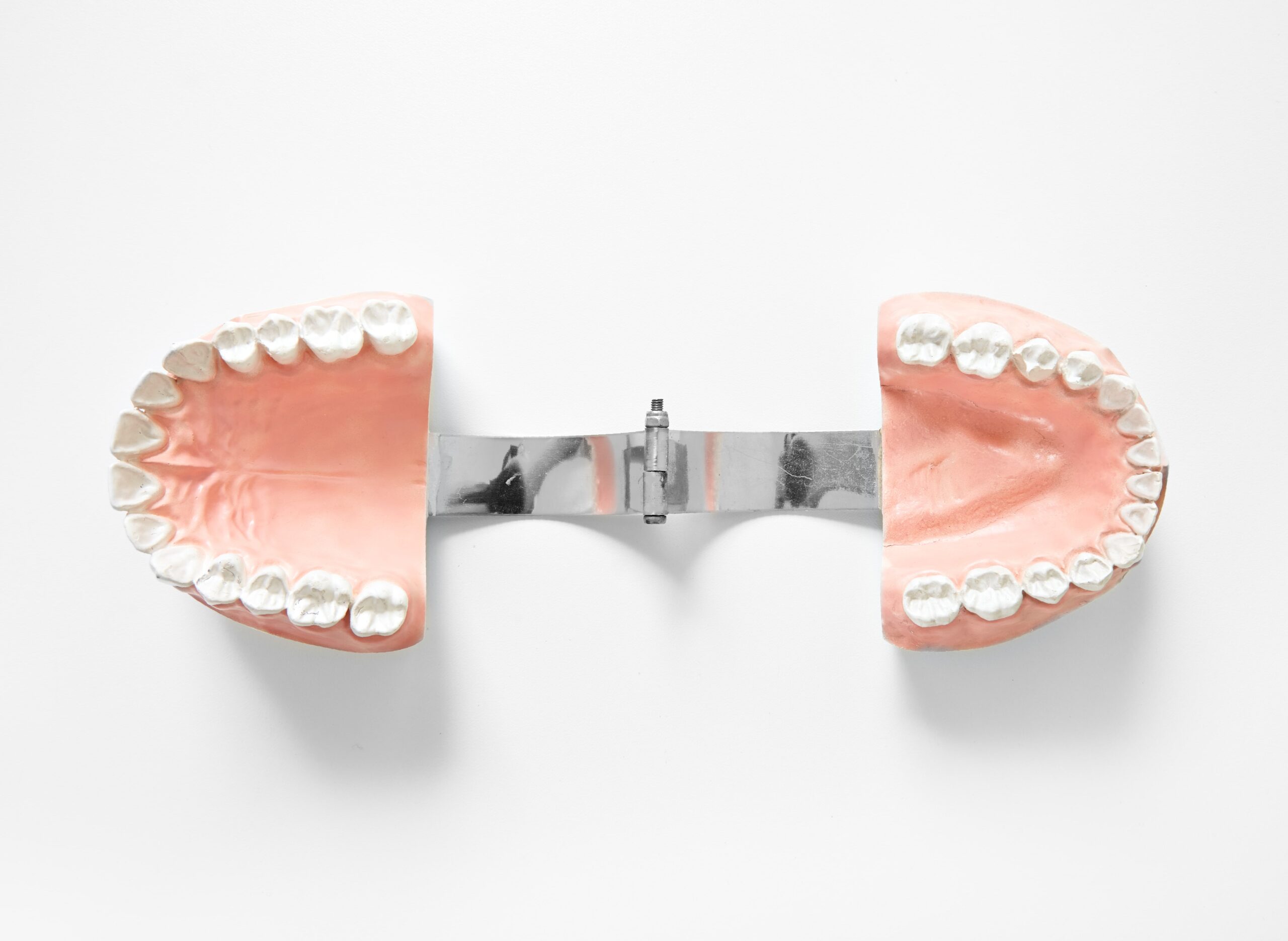 bone-graft-in-dental-implant