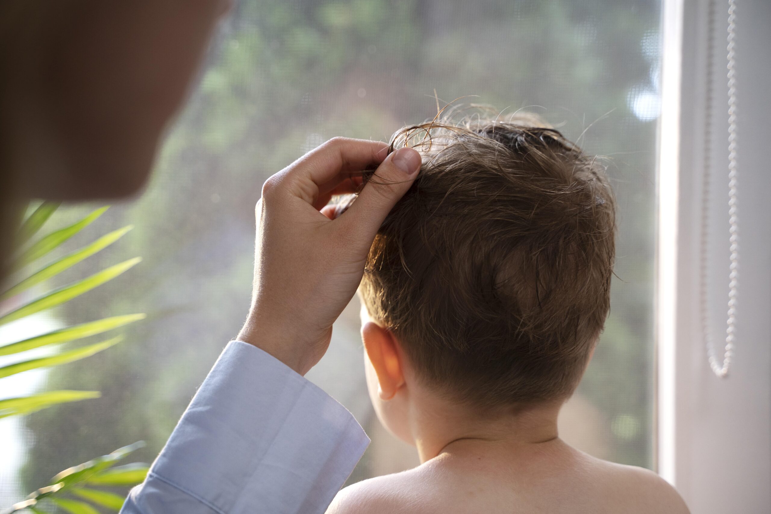 children-with-hairloss