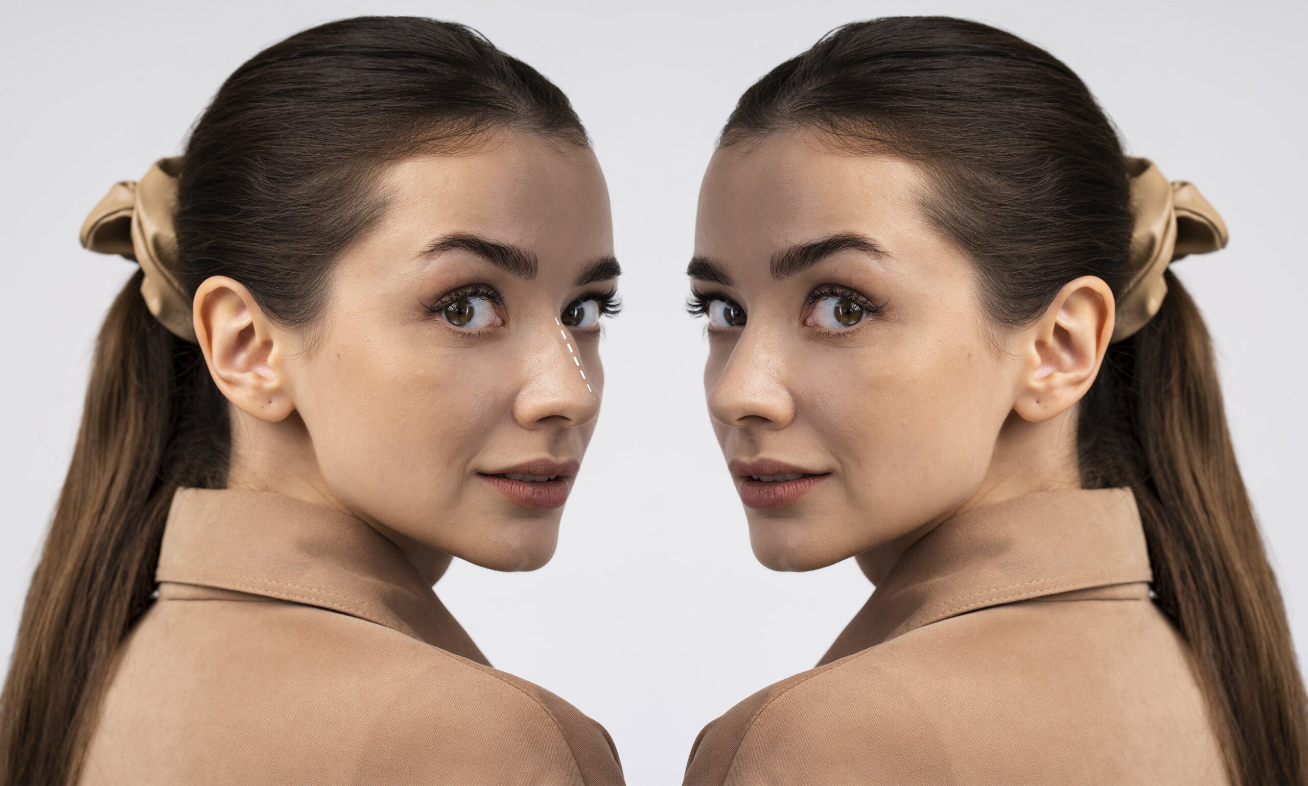 septoplasty-vs-rhinoplasty