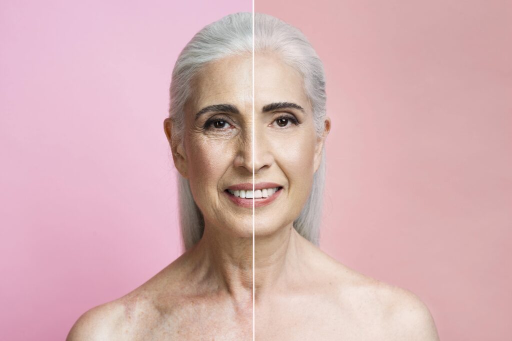 What Is Face Cellulite How To Be Treated WestModern Clinic what-is-face-cellulite-how-to-be-treated-westmodern-clinic
