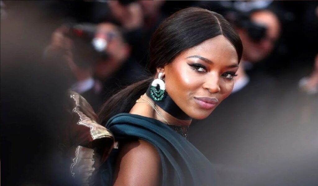 Hair Transplant Female Celebrities Naomi Campbell