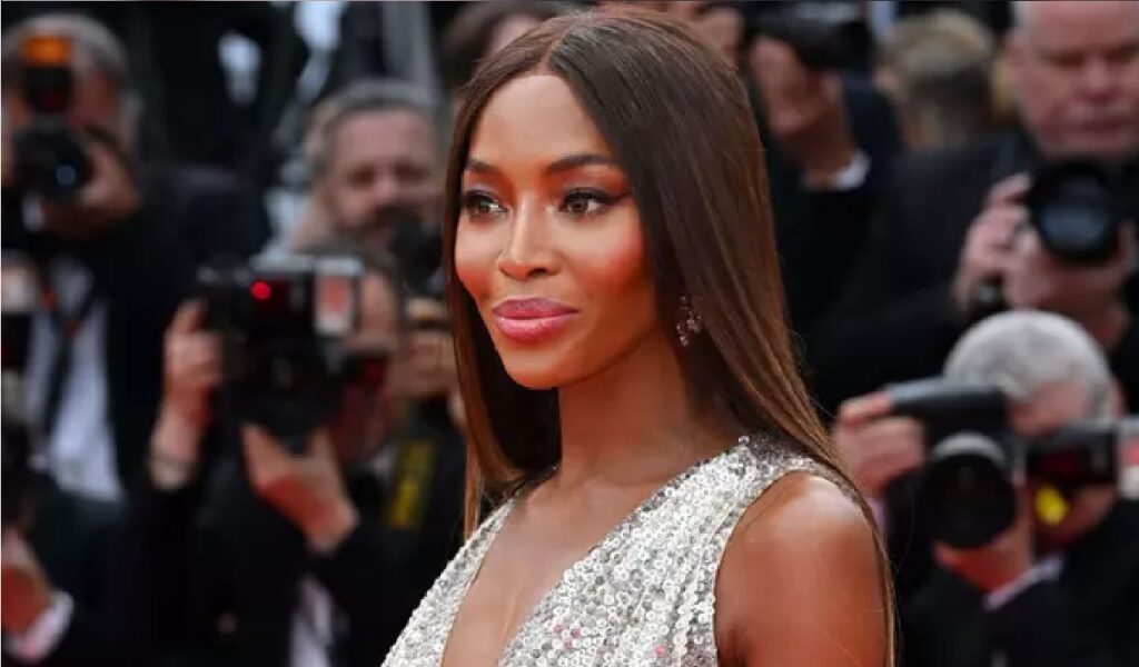 Hair Transplant Female Celebrities: Naomi Campbell