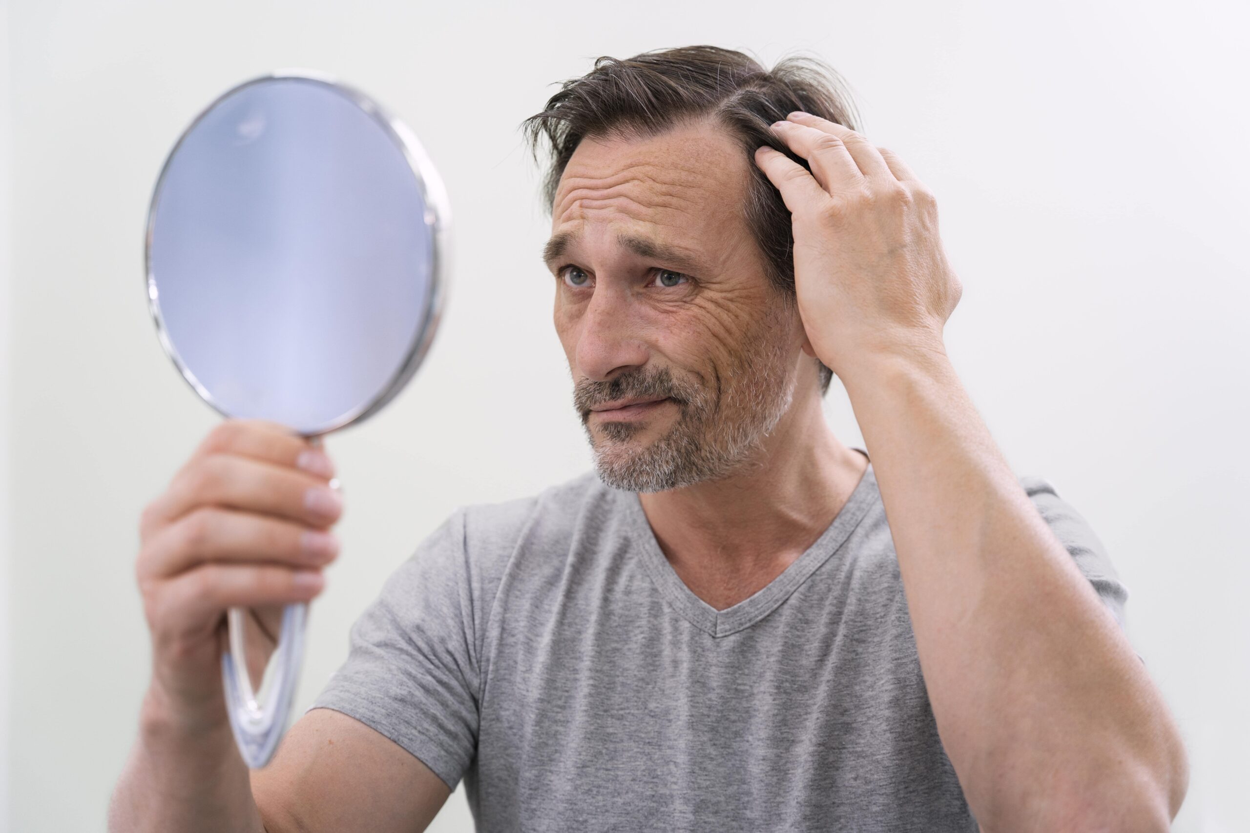 Hair Transplant for Men | 10 Most Important Detail