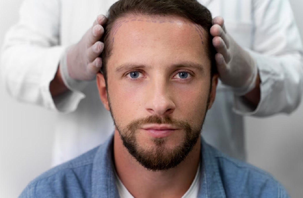 what-is-the-most-famous-hair-transplant-clinic-in-istanbul
