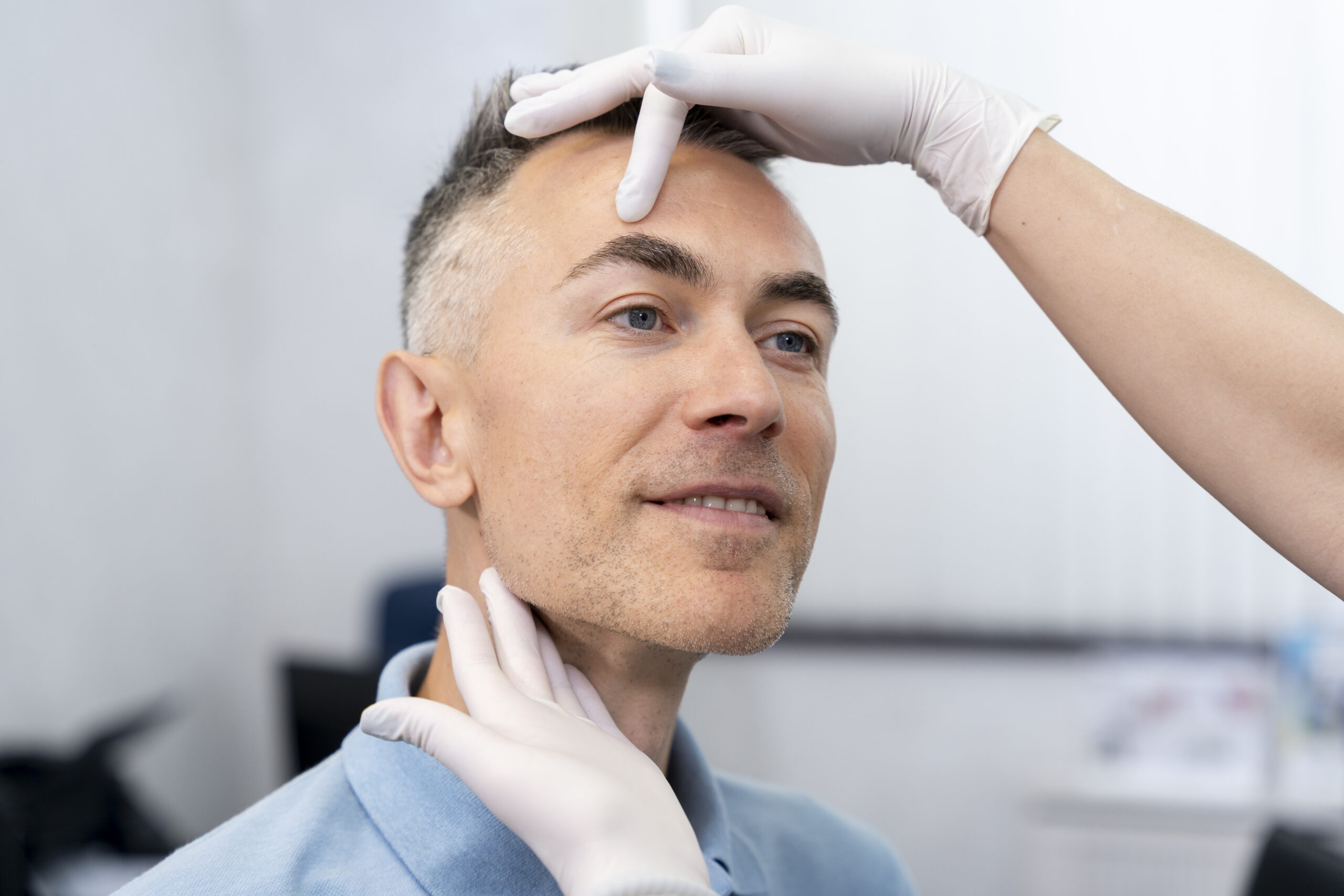 What Is Face Hair Transplant?