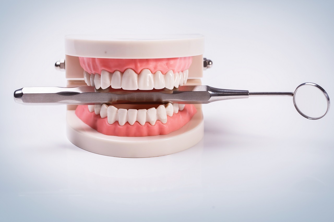 dental-implant-surgery