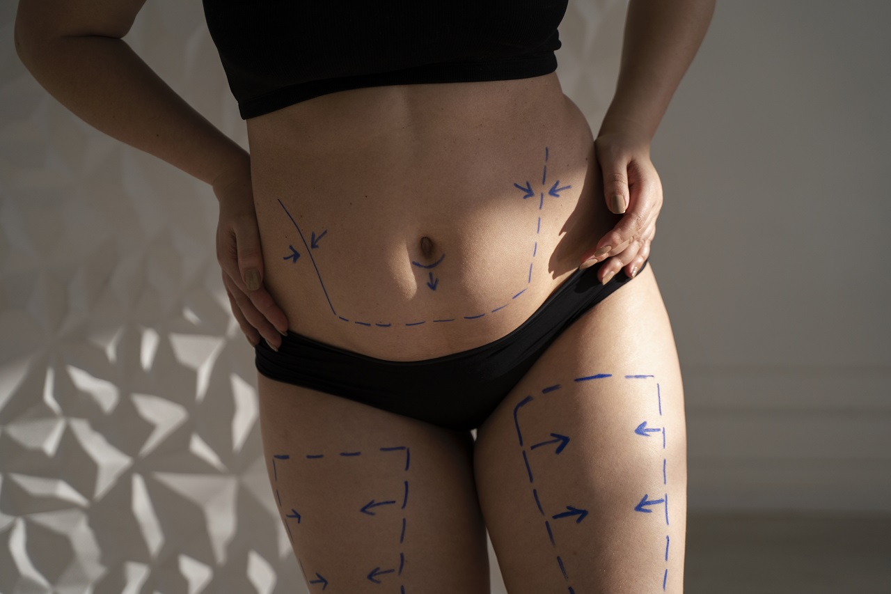 liposuction-risks