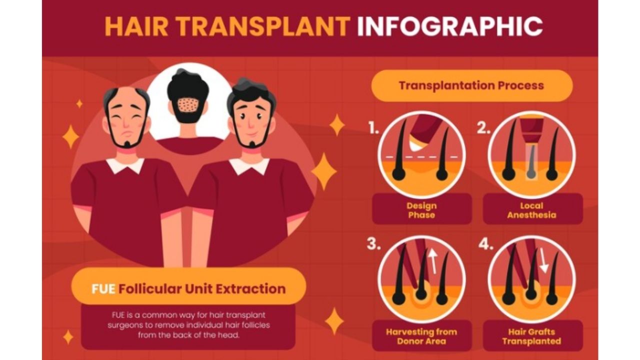 What Does Hair Transplant Growth Chart Look Like?